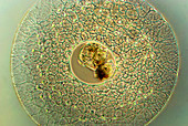 Actinosphaerium protozoan,micrograph