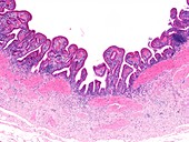 Gall bladder,light micrograph