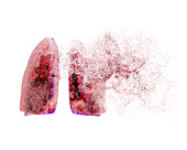 Lung disease,conceptual illustration
