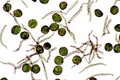 Liverwort (Pellia epiphylla) spores