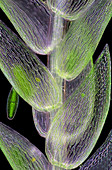 Sphagnum moss,light micrograph