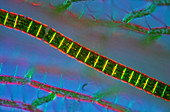 Desmid on sphagnum moss,light micrograph