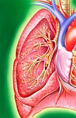Obstructive lung disease,illustration
