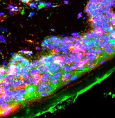 Dendritic immune cells,light micrograph