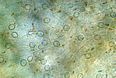 Hydra stinging cells,light micrograph