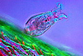 Rotifer on sphagnum moss,micrograph