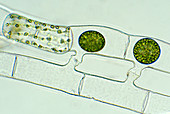 Spirogyra reproducing,light micrograph