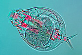 Lepadella rotifer,light micrograph