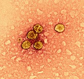 Hepatitis B virus particles,TEM