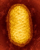 Orf virus particle,TEM