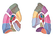 Lungs,illustration