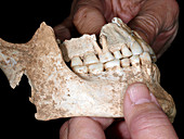 King Philip II of Macedon's jaw bones