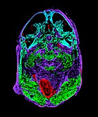 Zebrafish head,micro-CT scan