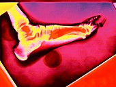 Foot,coloured X-ray