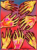 Hands,coloured X-ray