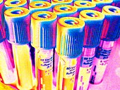 Blood vials,coloured image