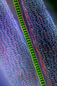 Desmid on sphagnum moss,micrograph