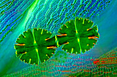 Desmids and sphagnum moss,micrograph
