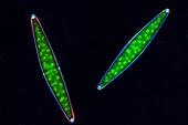 Closterium desmids,light micrograph