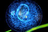 Actinosphaerium protozoan,micrograph
