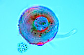 Shelled amoeba,light micrograph
