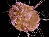 Dust mite. SEM