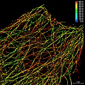 Microtubules,fluorescent micrograph