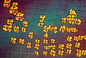 Crystals on waterflea,light micrograph