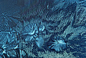 EDTA crystals,light micrograph