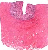Uterus,light micrograph