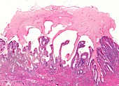 Gall bladder,light micrograph