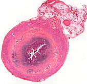 Appendix,light micrograph
