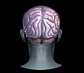 Normal brain,3D MRI scan
