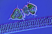 Diatoms and desmids,light micrograph
