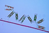 Diatoms and cyanobacteria,micrograph