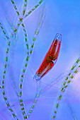 Diatom and green algae,light micrograph