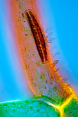 Epithemia diatom,light micrograph