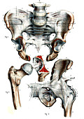 Hip joints,19th Century illustration