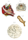 Prostate anatomy,19 Century illustration