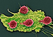 T lymphocytes and cancer cell,SEM