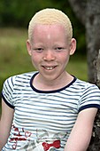 Young Albino Kosi Girl