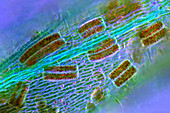 Epithemia diatoms,light micrograph