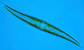 Gyrosigma diatom,light micrograph