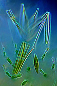 Diatoms and red algae,light micrograph
