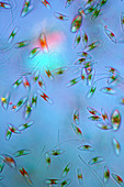 Cymbella diatoms,light micrograph