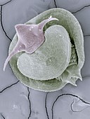 Clam shrimp larva,SEM