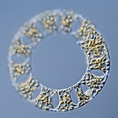 Eucampia diatom,LM