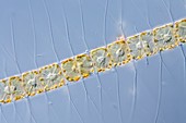 Chaetoceros diatom,LM