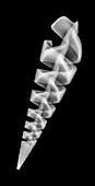 Spiral snail shell,X-ray