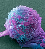 Skin cancer cell,SEM